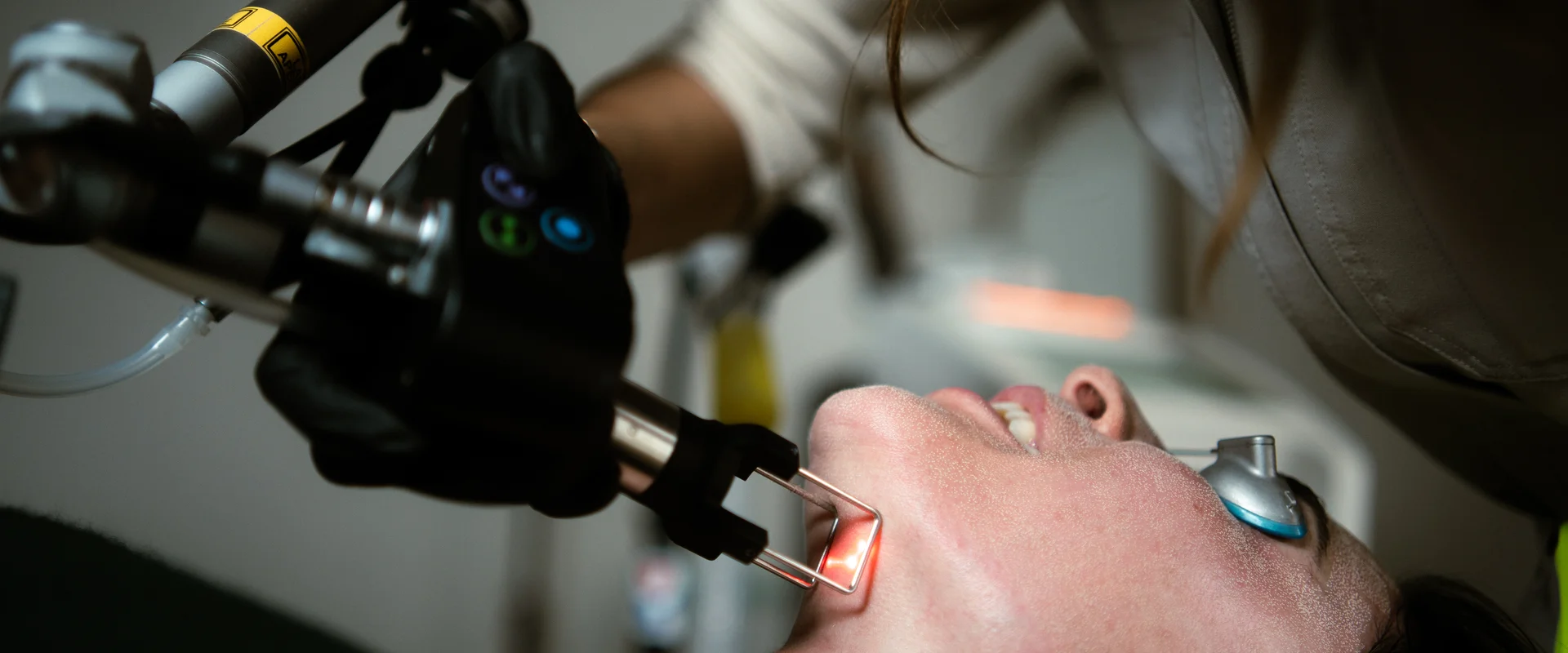CO2 laser resurfacing treatment at Nurture Wellness in Cherry Creek, Denver